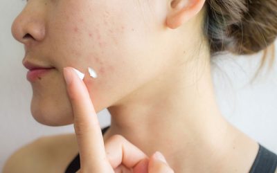 Organic Skincare for Adult Acne: A Calm, Consistent Approach